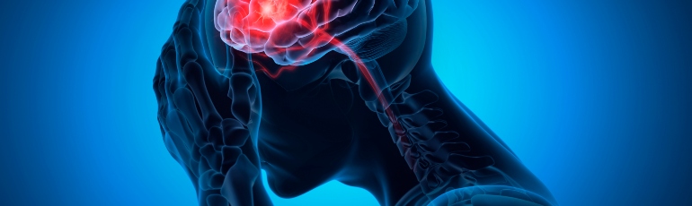 Traumatic brain injury in Sacramento, CA due to a car accident