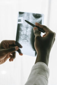 Spinal cord injury doctor looking at scans after accident in Sacramento, CA